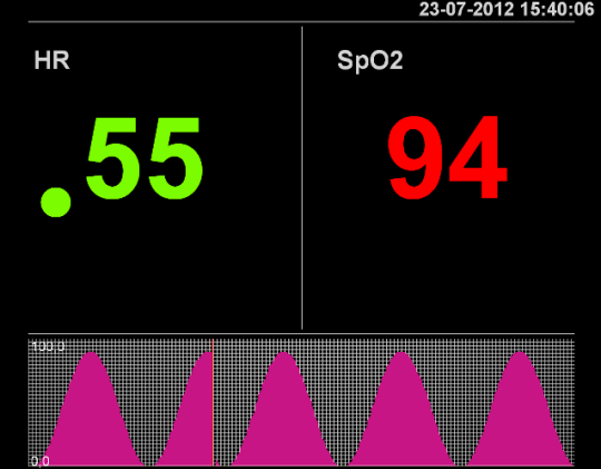 Patient Monitor